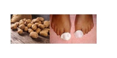 aardappelen voor nagelschimmel