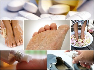 schimmel voet huid folk remedies